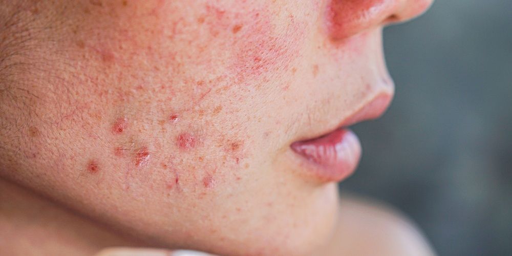 Yếu tố cơ thể ảnh hưởng đến khả năng tự bảo vệ của da