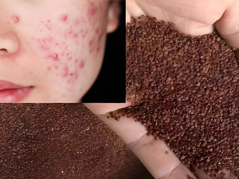 Hạt bị ẩm mốc, nhiễm khuẩn trong quá trình bảo quản có thể gây ra các phản ứng như mẩn đỏ, ngứa rát, thậm chí khiến da nổi mụn