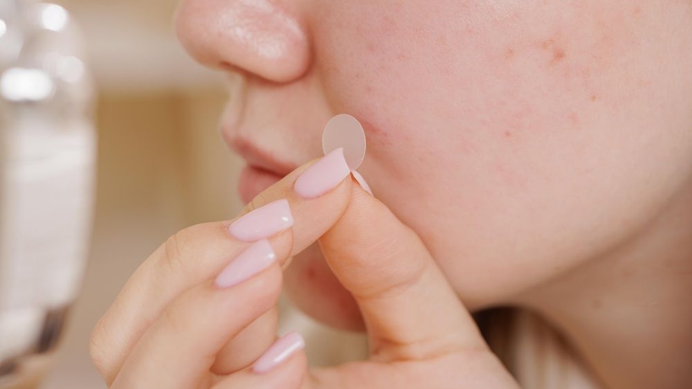 Hướng dẫn cách dùng miếng dán mụn trên da sạch