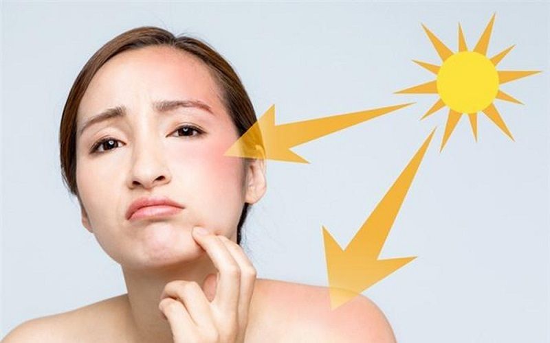 việc bỏ qua kem chống nắng cho da dầu mụn lại là một quyết định vô cùng tai hại, bởi tia UV có thể gây ra những hậu quả nghiêm trọng