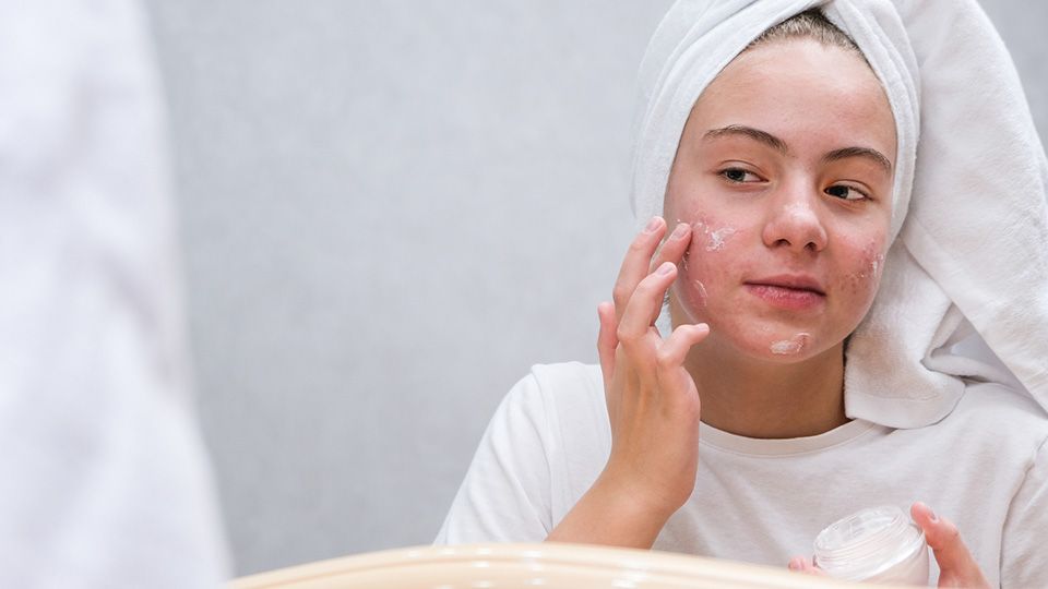 retinol có trị mụn không hình 1.jpg