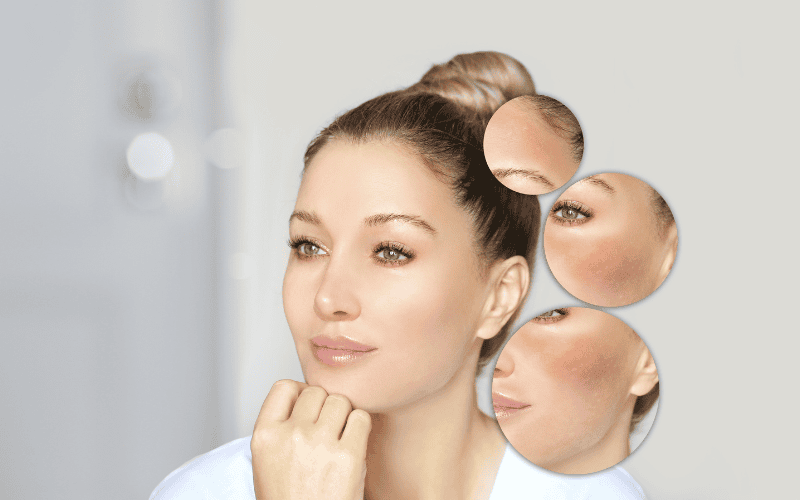 Các thành phần nên có trong serum trị nám