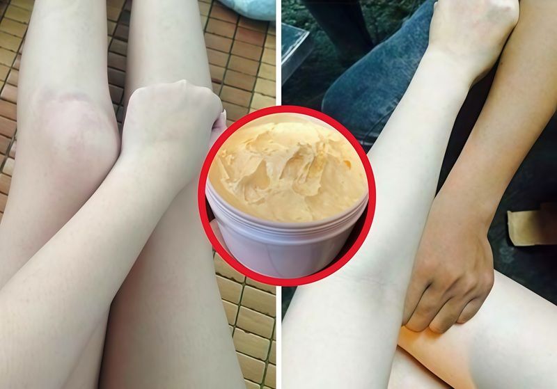 Người làm kem trộn thường tự ý kết hợp các hoạt chất có tác dụng mạnh như Corticoid, hydroquinone hoặc thủy ngân để tạo hiệu quả làm trắng cấp tốc