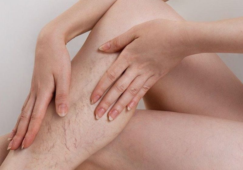 Việc bạn cần làm là ngưng dùng kem trộn và đến gặp bác sĩ da liễu để được thăm khám, đưa ra phác đồ điều trị phục hồi da chuyên biệt